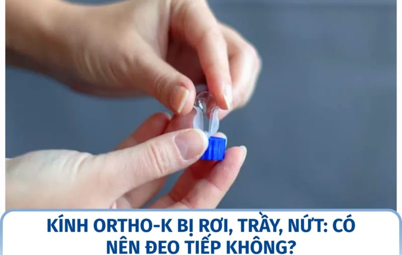 Kính Ortho-K bị rơi, trầy, nứt: có nên đeo tiếp không?