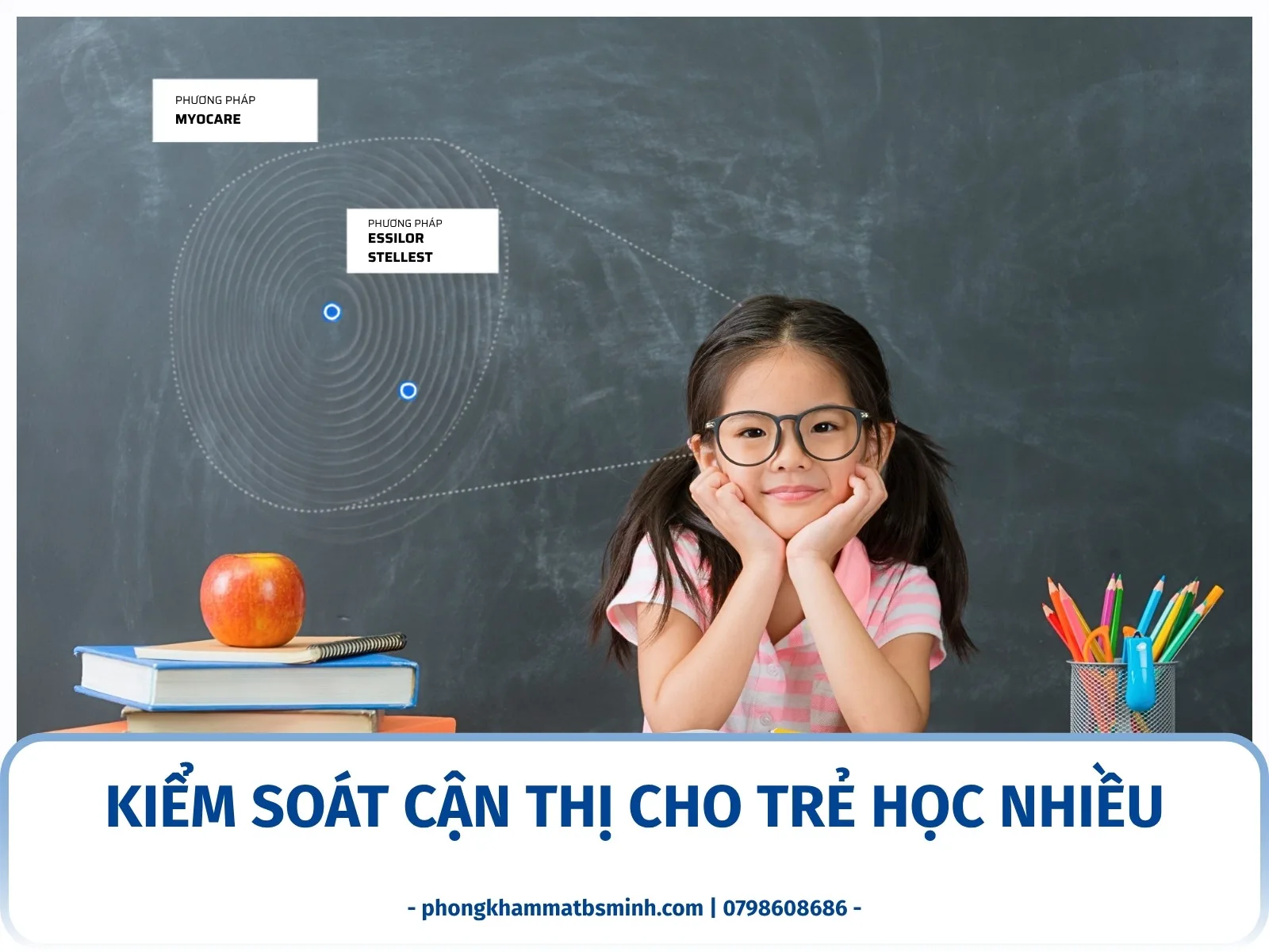 Kiểm soát cận thị cho trẻ học nhiều
