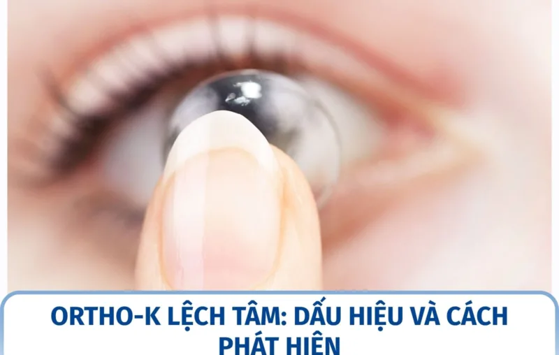 Ortho-K lệch tâm: dấu hiệu và cách phát hiện
