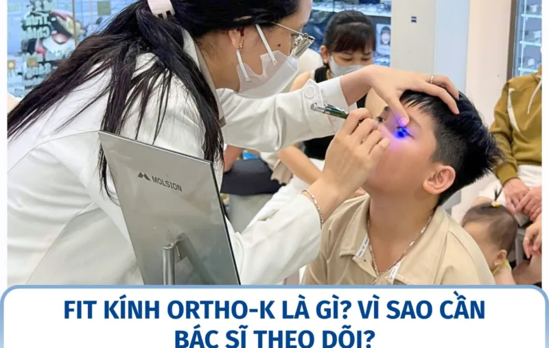 Fit kính Ortho-K là gì? Vì sao cần bác sĩ theo dõi?