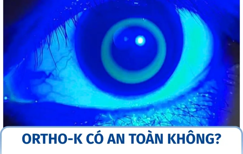 Ortho-K có an toàn không?
