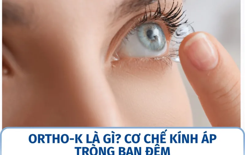 Ortho-K là gì? Cơ chế kính áp tròng ban đêm