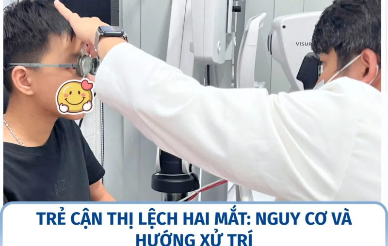 Trẻ cận thị lệch hai mắt: nguy cơ và hướng xử trí