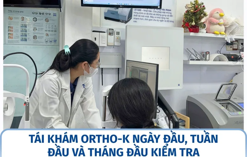 Tái khám Ortho-K ngày đầu, tuần đầu và tháng đầu kiểm tra