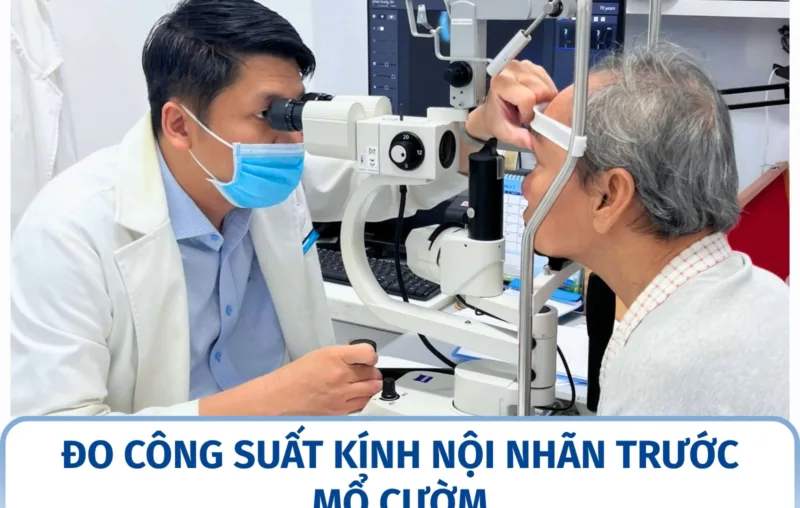 Đo công suất kính nội nhãn trước mổ cườm