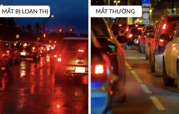 Nhìn chữ bị bóng là do loạn thị hay khô mắt?
