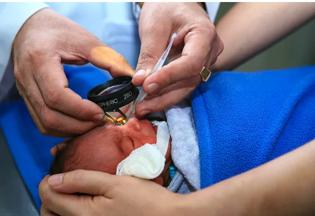 Khám mắt cho trẻ sinh non vì sao cần theo dõi võng mạc?
