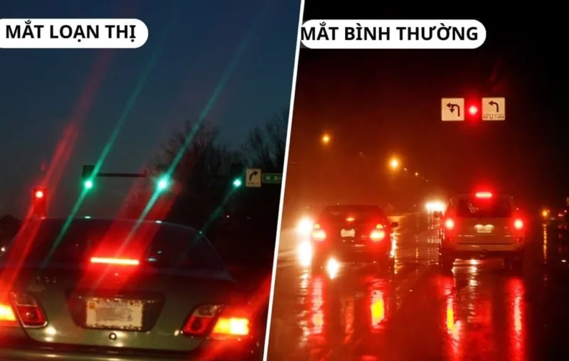 Loạn thị là gì? Sai trục loạn thị dễ gây nhức mắt