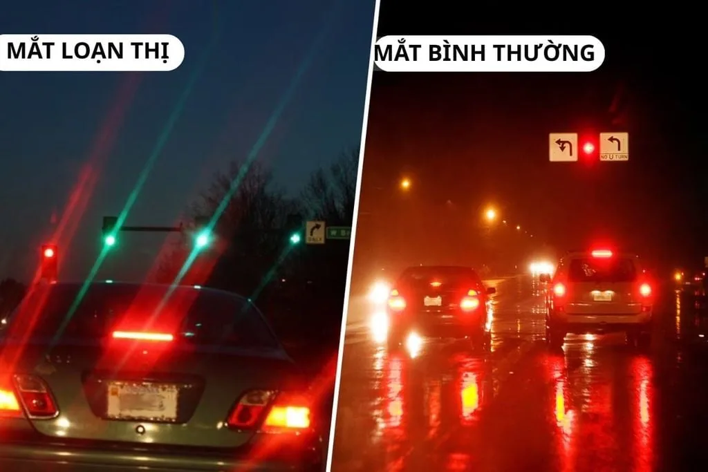 Loạn thị là gì? Sai trục loạn thị dễ gây nhức mắt
