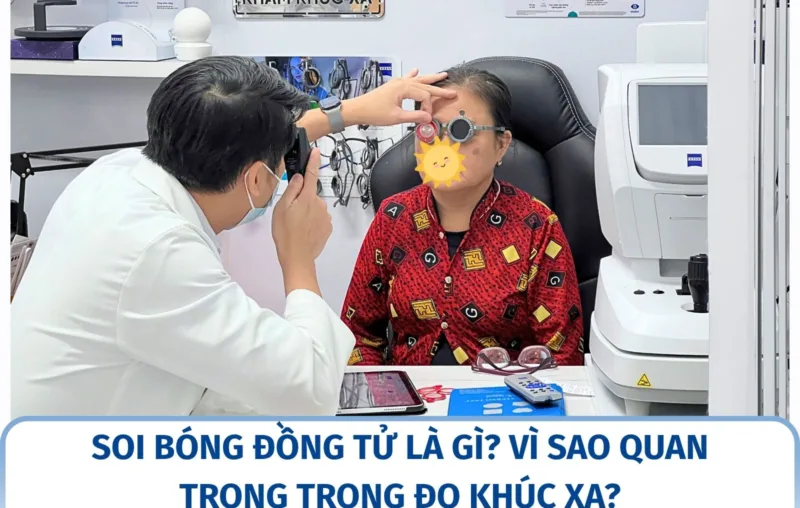 Soi bóng đồng tử là gì? Vì sao quan trọng trong đo khúc xạ?