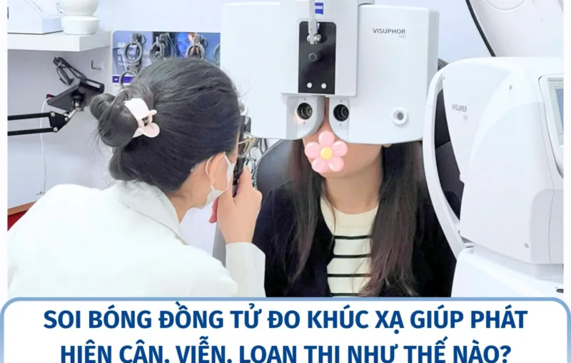 Soi bóng đồng tử đo khúc xạ giúp phát hiện cận, viễn, loạn thị như thế nào?