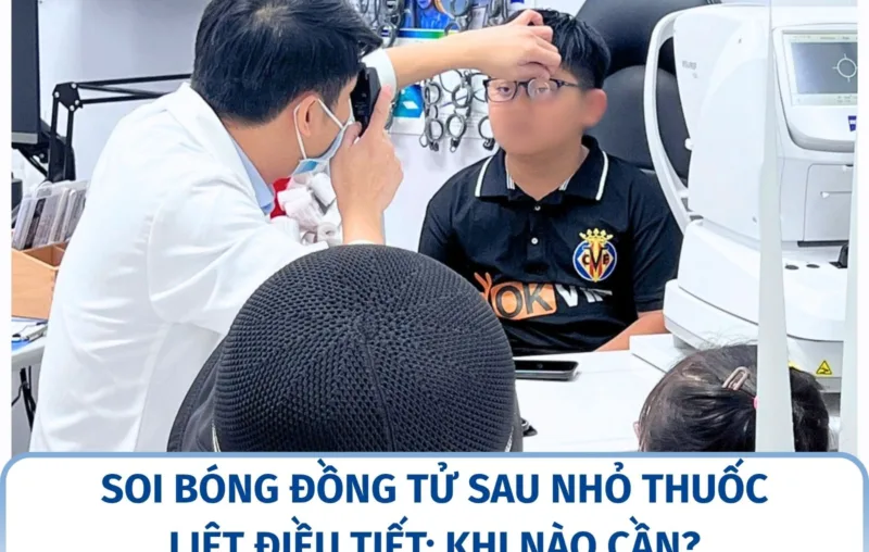 Soi bóng đồng tử sau nhỏ thuốc liệt điều tiết: khi nào cần?