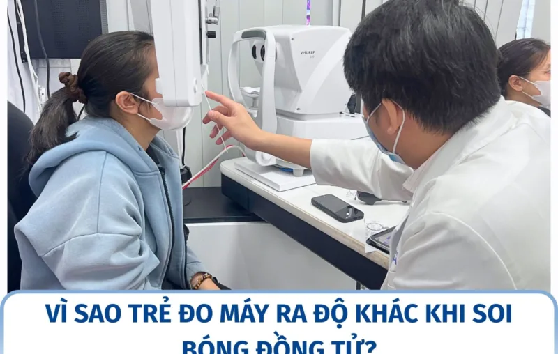Vì sao trẻ đo máy ra độ khác khi soi bóng đồng tử?