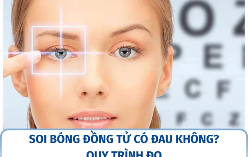 Soi bóng đồng tử có đau không? Quy trình đo