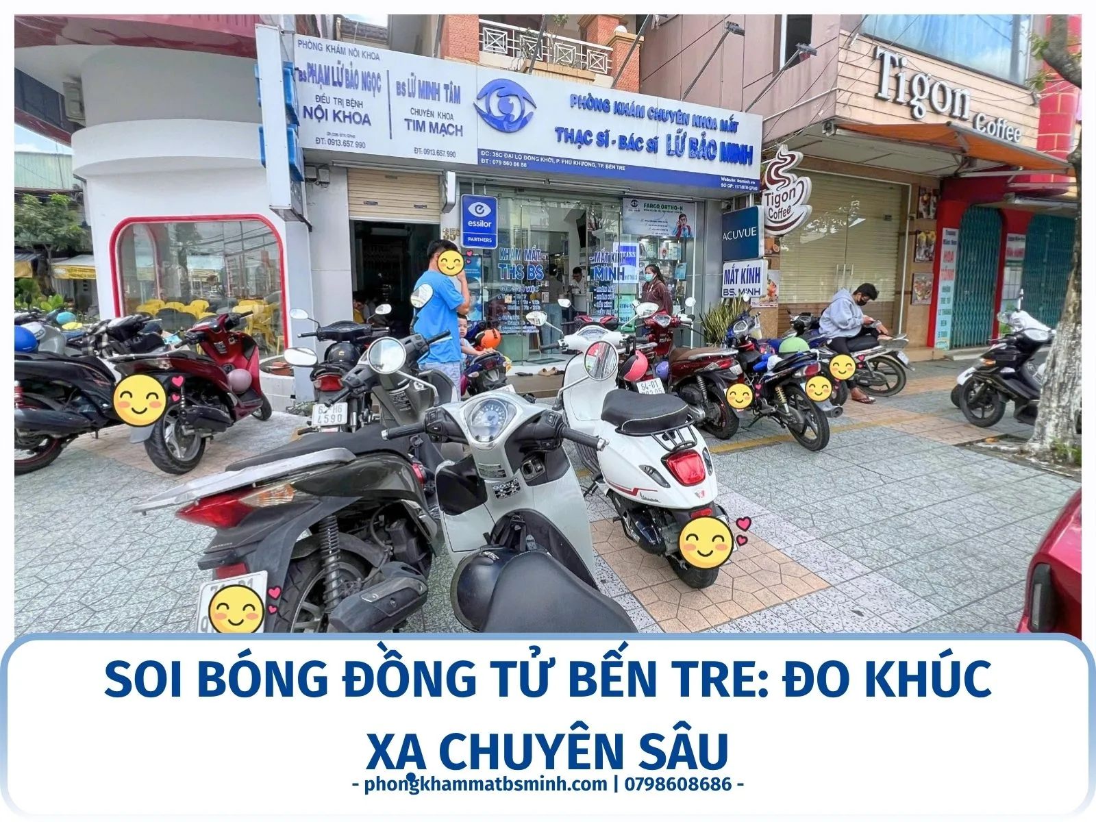 Soi bóng đồng tử Bến Tre: đo khúc xạ chuyên sâu
