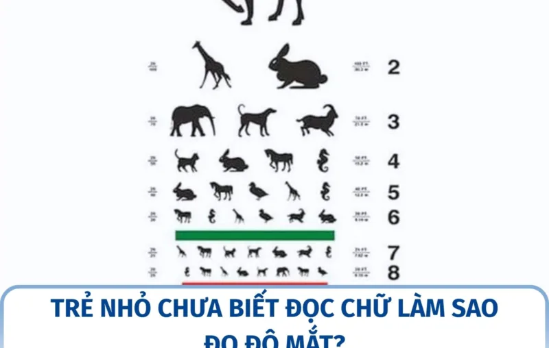 Trẻ nhỏ chưa biết đọc chữ làm sao đo độ mắt?