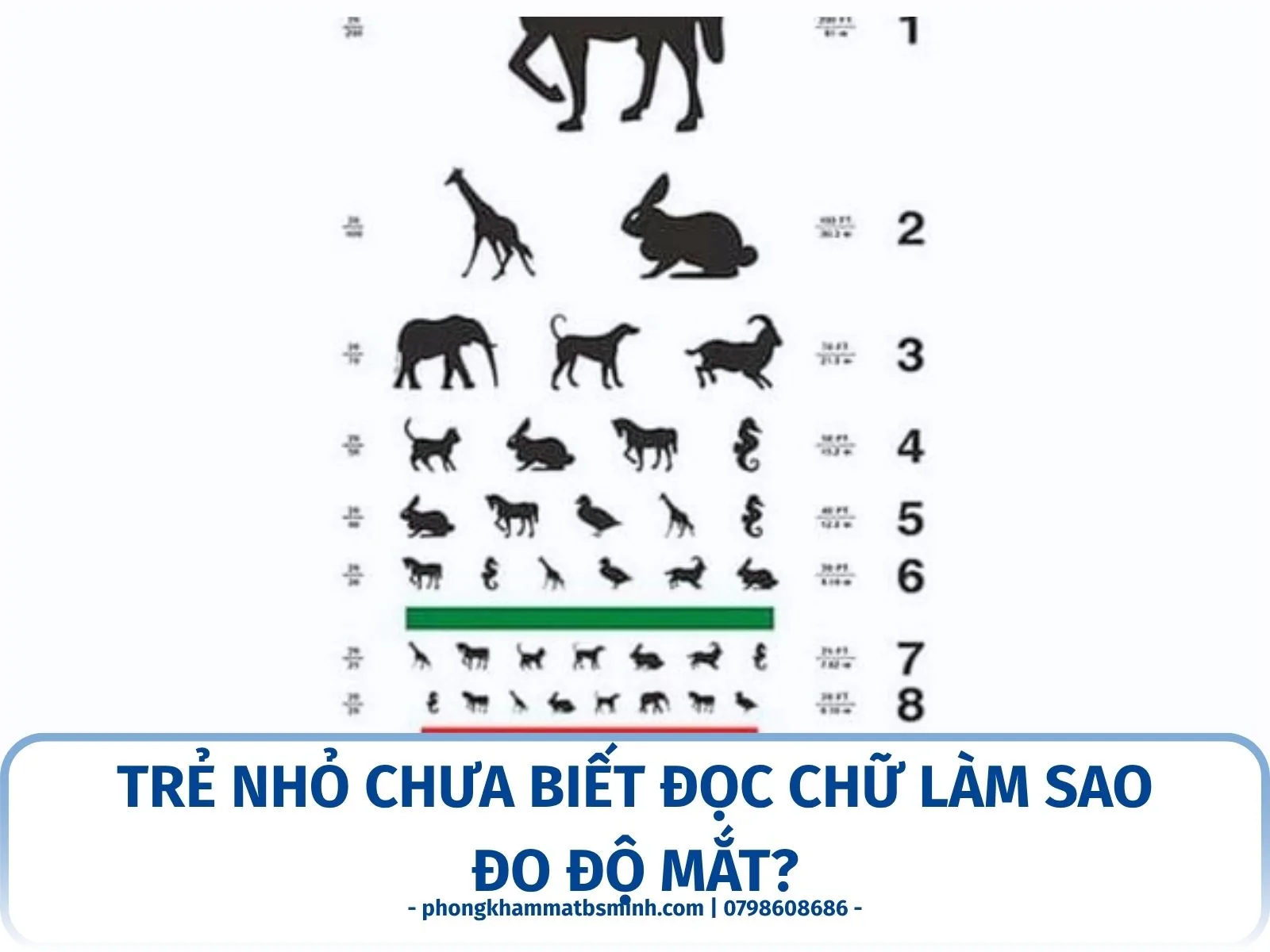 Trẻ nhỏ chưa biết đọc chữ làm sao đo độ mắt?