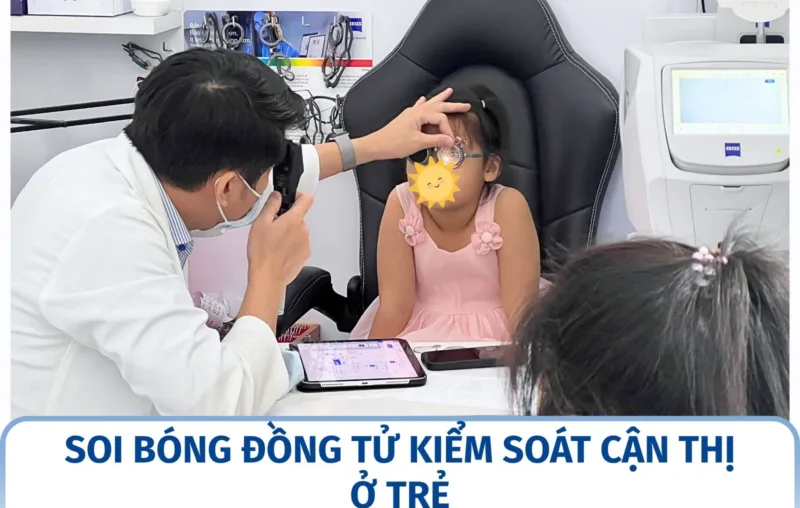 Soi bóng đồng tử kiểm soát cận thị ở trẻ