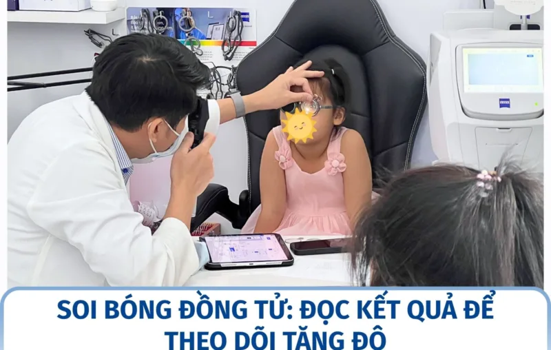 Soi bóng đồng tử: đọc kết quả để theo dõi tăng độ